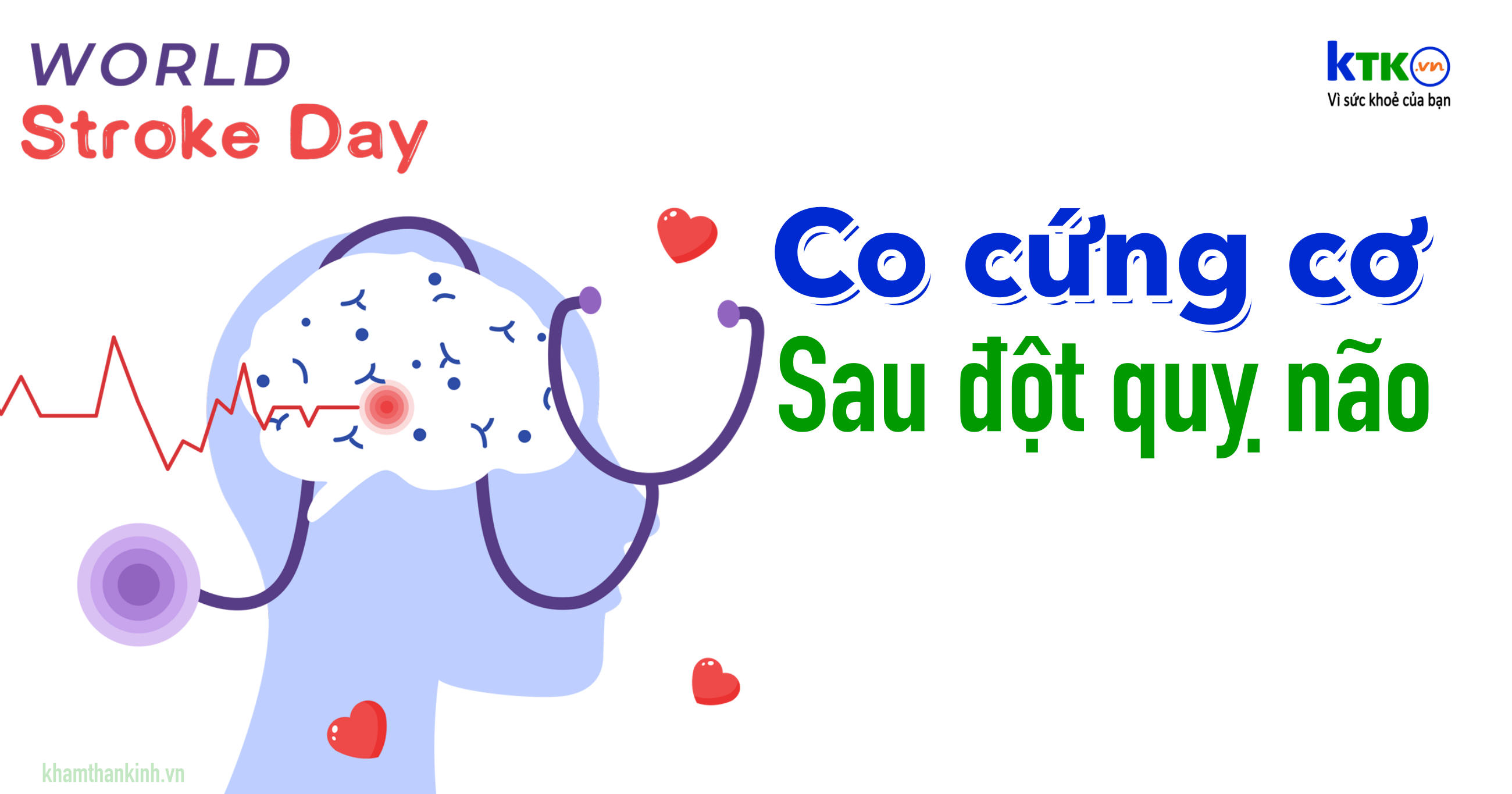 Co cứng cơ sau đột quỵ não ... Nên được chẩn đoán sớm và điều trị đúng cách.